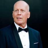 Bruce Willis has been diagnosed with frontotemporal dementia