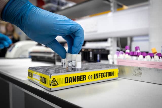 A clinical support technician extracts viruses from swab samples so that the genetic structure of a virus can be analysed and identified in the coronavirus testing laboratory at Glasgow Royal Infirmary, on February 19, 2020 in Glasgow, Scotland. Credit: Getty Images