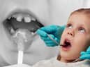 Thousands of children in England had rotten teeth removed last year (Image: Adobe/NationalWorld/Kim Mogg)