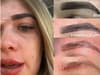 Woman issues cosmetic treatment warning after spending over £1,200 to undo botched eyebrow procedure