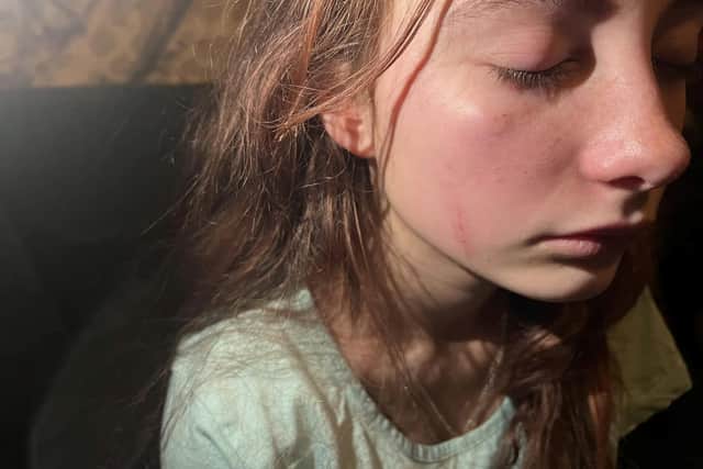 The 12-year-old was beaten up by her school peers who posted footage on social media (Photo: SWNS)