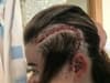 Woman who dismissed ‘constant headaches’ diagnosed with rare incurable brain tumour