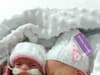 Premature twins, who were 'killing each other' in the womb, have made miracle recovery after birth at 28 weeks