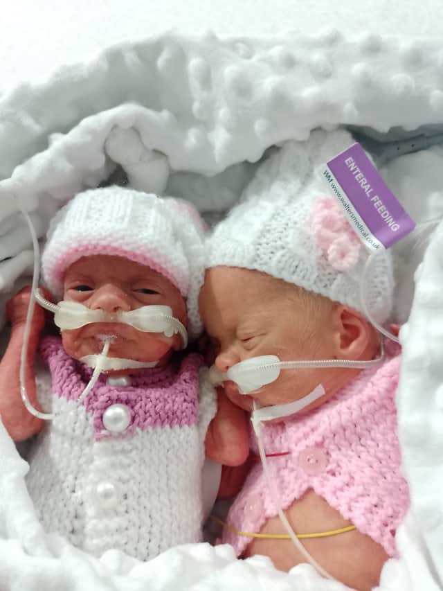 Meabh Weir was born first, weighing 1lbs 6oz, and her sister, Clodagh Weir, was born shortly after weighing 2lbs 8oz. Credit: SWNS
