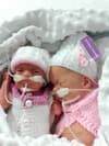 Premature twins, who were 'killing each other' in the womb, have made miracle recovery after birth at 28 weeks