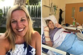 Beth Budgen before falling ill (left) and after having her legs amputated and plastic surgery on her hand due to sepsis. (Pictures: Contributed)
