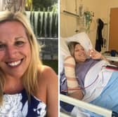 Beth Budgen before falling ill (left) and after having her legs amputated and plastic surgery on her hand due to sepsis. (Pictures: Contributed)