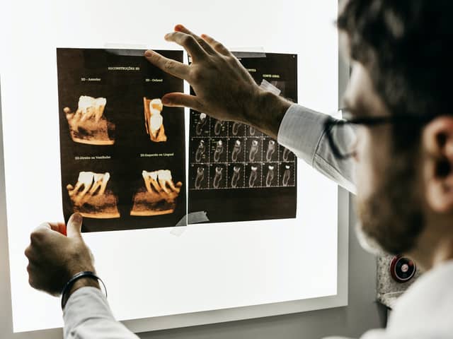 Radiographers are responsible for carrying out X-rays, MRI and CT scans, ultrasounds, breast screenings, as well as radiotherapy for cancer patients.