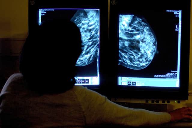 Radiographers begin 48-hour strike - full list of affected NHS Trusts. (Photo: Rui Vieira/PA Wire) 