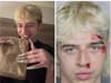 Icy Wyatt: TikTok star re-arrested a year after assault charges - plus the date he'll face trial