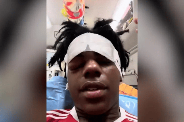 YouTube star iShowSpeed had fans in worry when he shared pictures of him from a hospital bed with an inflamed eye on social media - Credit: YouTube