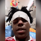YouTube star iShowSpeed had fans in worry when he shared pictures of him from a hospital bed with an inflamed eye on social media - Credit: YouTube