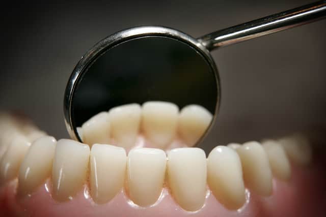 Teeth on a model denture set are reflected in a dental mirror on April 19, 2006 in Great Bookham, England. (Photo by Peter Macdiarmid/Getty Images)