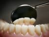 Teeth regrowth: scientists develop a groundbreaking new drug to create a new set of teeth