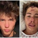 Teenager Caleb Coffee says it is a 'miracle' he is alive after falling 80ft on to lava rock while out hiking in Hawaii. He is pictured right in his hospital bed (TikTok/Caleb Coffee) and left before the accident (Instagram/Caleb Coffee)