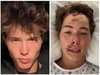 Caleb Coffee: Who is TikTok star, how old is he, what happened in Hawaii hiking accident, how is he now?