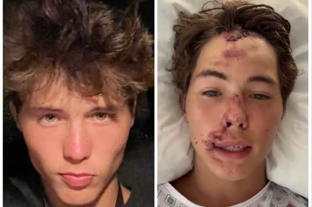Teenager Caleb Coffee says it is a 'miracle' he is alive after falling 80ft on to lava rock while out hiking in Hawaii. He is pictured right in his hospital bed (TikTok/Caleb Coffee) and left before the accident (Instagram/Caleb Coffee)