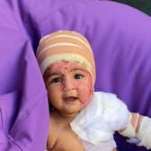 Alaya, aged just one, managed to knock the hot beverage onto her face and was sent to a burns unit for treatment - Credit: SWNS