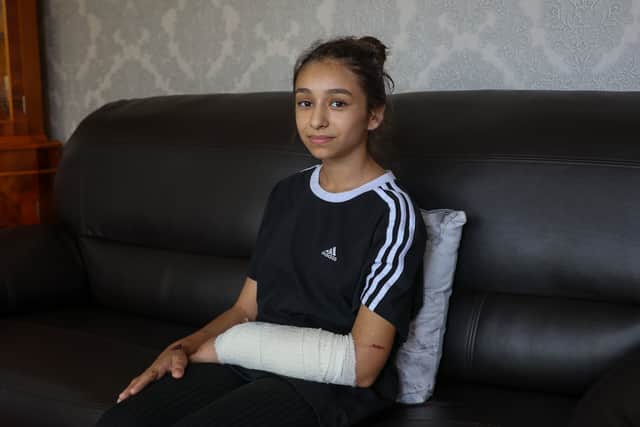 Ana Paun with her arm bandaged after being attacked by the American XL Bully dog in Bordesley Green, Birmingham, on Saturday (Photo: Anita Maric / SWNS)