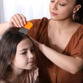 Parents share their best hacks for treating headlice and nits on TikTok. Image by Adobe Photos.
