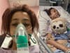 Vaping leaves girl, 12, in coma after her lungs became too ‘weak’ to fight infection