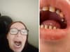 Woman who flew to Turkey for new teeth "wish I never went"