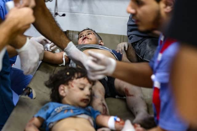 Warning: Graphic content Injured children at Al-Shifa hospital - among scores who have been impacted or killed by the devastating fighting in Gaza