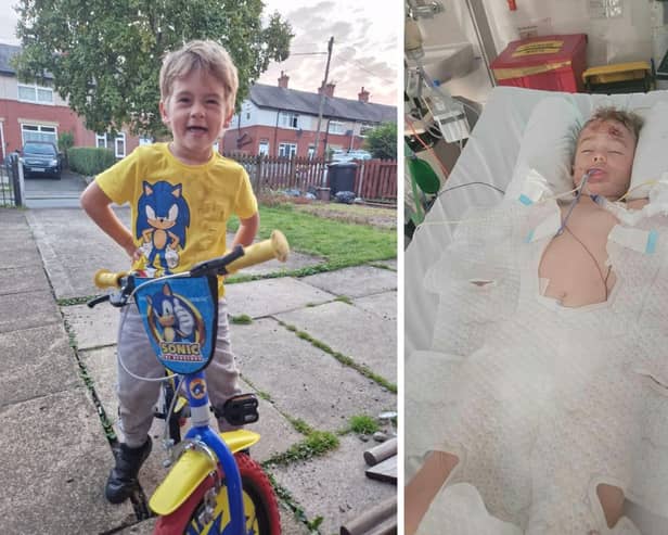 Marli Barnes was in a coma for nine days after a horrific bike crash - his mum is urging parents to make sure their children wear helmets 