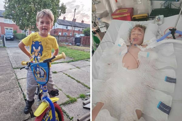 Marli Barnes was in a coma for nine days after a horrific bike crash - his mum is urging parents to make sure their children wear helmets 