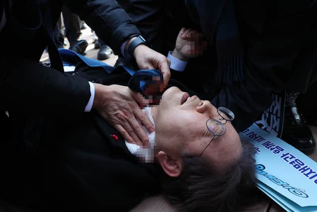South Korea opposition leader, Lee Jae-myung, was stabbed in the neck by an unidentified man as he walked through a crowd of journalists during a visit to Busan. (Photo: The Busan Daily News via Getty Images)