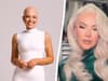 Alopecia: Devon influncer wants to "empower" others after her hair fell out at 16 years old