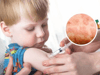 Measles: What is the "national call to action" and how can you protect your children?