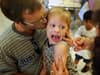 Measles symptoms: rash, what is measles, symptoms in adults, UK outbreak explained - as cases soar