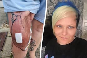 Michelle Milton, from Essex, is begging doctors for an amputation as her leg "oozes pus" every single day. (Picture: SWNS)
