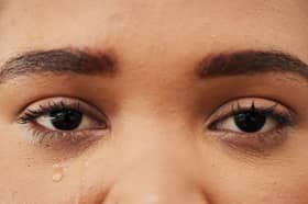 A TikTok beauty influencer has claimed that using Vaseline will help stop watering eyes in the cold weather, but two experts are unsure about the safety of the supposed health hack. Stock image by Adobe Photos.