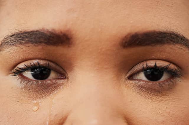 A TikTok beauty influencer has claimed that using Vaseline will help stop watering eyes in the cold weather, but two experts are unsure about the safety of the supposed health hack. Stock image by Adobe Photos.