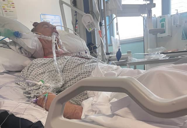 Lee Burns had been to the Grand National with a group of friends when he was punched outside a bar in Poulton-le-Fylde, Lancashire. Picture: Sara Smith-Burns / SWNS