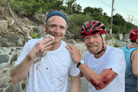 Virgin Group founder Richard Branson has shared an image of the bloody injuries both he and friend Alex Wilson suffered following a cycling accident in Virgin Gorda. (Credit: Richard Branson/Instagram)