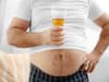 Having a beer belly means you're more likely to get dementia, researchers conclude