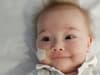 Botulism: Baby 'completely paralysed' by extremely rare toxin found in dirt and honey saved