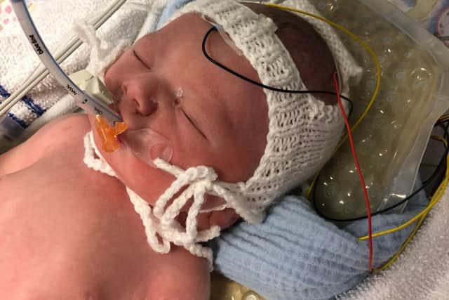 Orlando died on September 24, 2021, at Royal Sussex County Hospital in Brighton, due to severe hypoxic ischaemic encephalopathy – a brain injury caused by fits his mother, Robyn Davis, from Steyning, experienced during pregnancy.