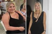 Ashleigh Pomeroy lost nine stone after having a gastric band operation. (Picture: SWNS)