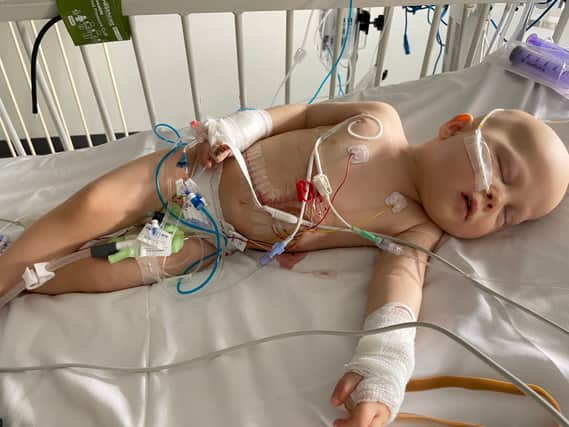 Toddler Jaxon Barnes after receiving a life-saving liver resection at Leeds General Hospital. Picture: Hayley Barnes / SWNS
