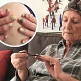 Val St.Clair from Glastonbury was the only patient on the cancer unit who still had perfect nails by the end of chemotherapy after finding out about Polybalm. Picture: Robert Thomas