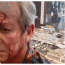 Celebrity antiques dealer Ian Towning reveals injuries after being attacked in store by two men with hammers. ian.towning/Instagram