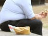 Obesity: Tricks to lose weight without starving yourself according to Professor Robert Thomas
