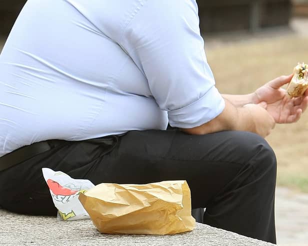 World obesity rates have tripled over the last 30 years but Professor Robert Thomas has some tips on losing weight that's not just about counting calories. Picture: Dominic Lipinski/PA Wire