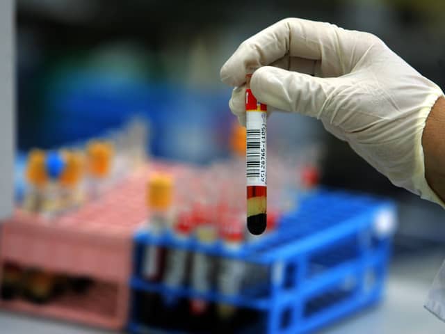 A revolutionary new blood test is set to begin trials in the UK, with the aim of helping to make early diagnosis of Azheimer's disease and dementia accessible to all. (Credit: Getty Images)