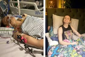 Rachel Downes, then 28, was hit head-on by a drunk driver in 2021 and broke almost every bone in her body. She was in a coma and was not expected to survive, and later felt so down she attempted suicide Pictures: SWNS