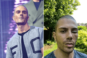 The Wanted and former Glee actor Max George has left fans concerned after posting an image (right) of his eye swollen and strapped closed. The image was deleted from Instagram a short while later (Credit: Getty/Instagram)